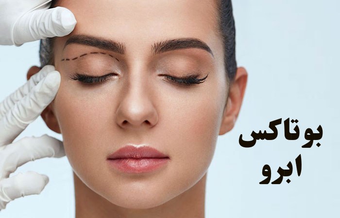 بوتاکس ابرو